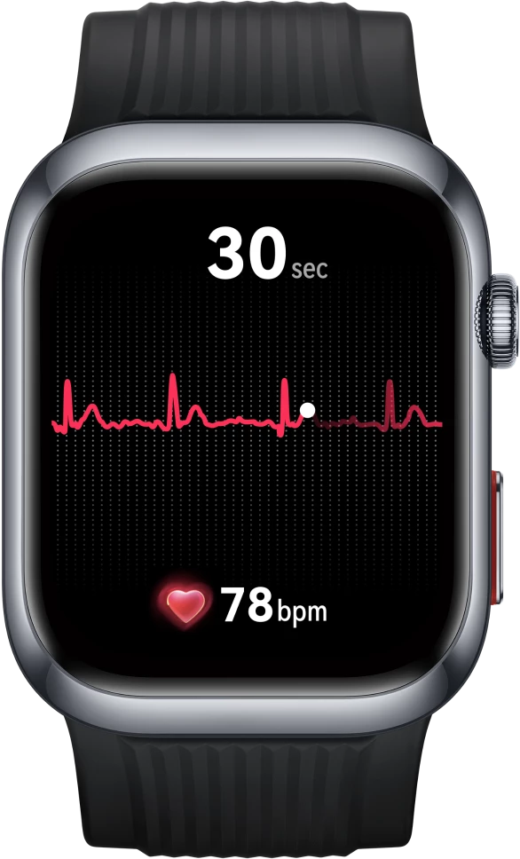 ECG on the watch screen