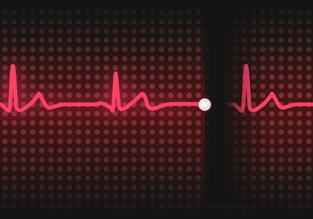 EKG egri chizig‘i